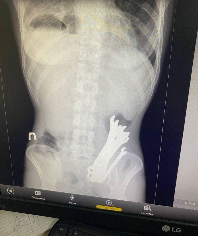 �������� ��������� ����� ������� ������ ����� ��������� �����